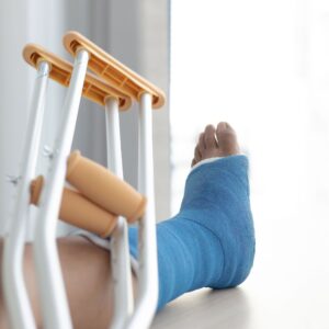broken leg