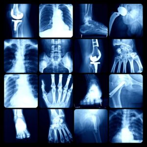 medical x-rays