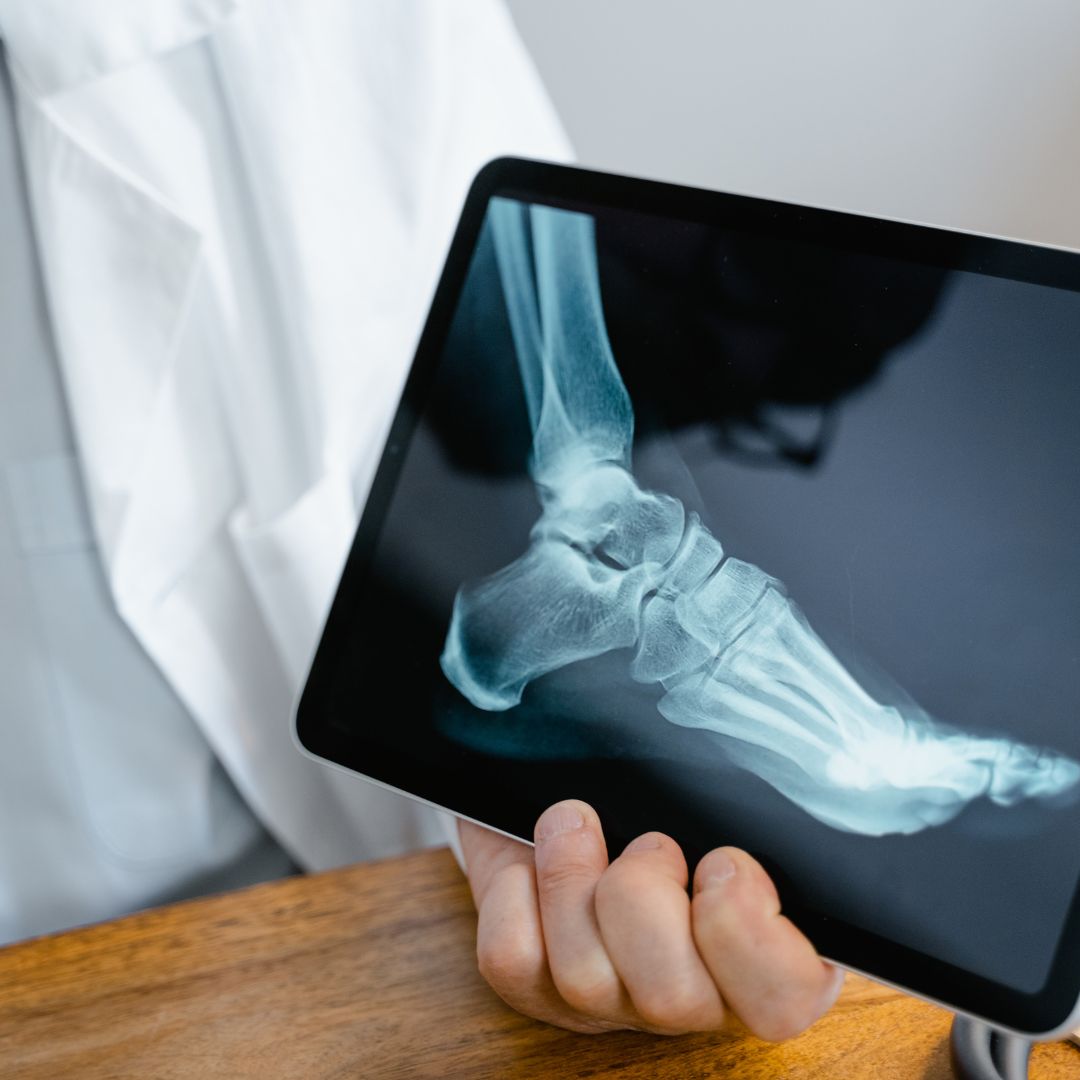 x ray